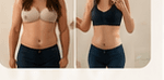 before and after